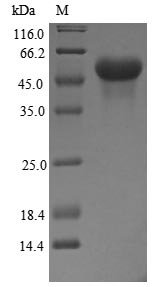 Recombinant Human Glucocorticoid receptor (NR3C1), partial