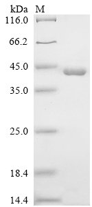 Recombinant Human Glucocorticoid receptor (NR3C1), partial