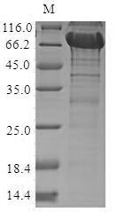 Recombinant Human Transforming growth factor beta activator LRRC33 (NRROS), partial