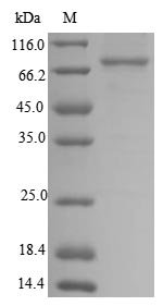 Recombinant Human Transforming growth factor beta activator LRRC33 (NRROS), partial