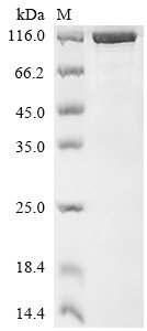 Recombinant Human Nuclear pore complex protein Nup85 (NUP85)