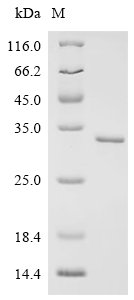 Recombinant Human Origin recognition complex subunit 1 (ORC1), partial