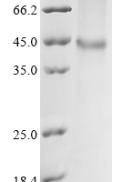 (Tris-Glycine gel) Discontinuous SDS-PAGE (reduced) with 5% enrichment gel and 15% separation gel.
