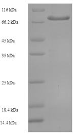 Recombinant Human Transmembrane prolyl 4-hydroxylase (P4HTM), partial