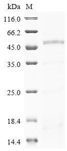 Recombinant Human Phenylalanine-4-hydroxylase (PAH), Homo sapiens (Human), E.coli, Tag-Free, 51.9kDa, purity >90% as determined by SDS-PAGE.