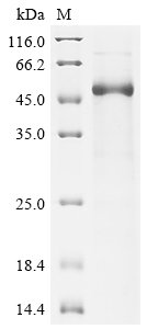 Recombinant Human Phenylalanine-4-hydroxylase (PAH)