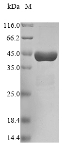 Recombinant Human Parkinson disease protein 7 (PARK7), partial