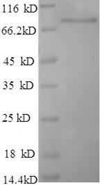Recombinant Human Poly (A)-specific ribonuclease PARN (PARN), Homo sapiens (Human), E.coli, N-terminal 6xHis-tagged, 77.5kDa, purity >90% as determined by SDS-PAGE.