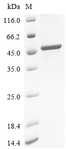 Recombinant Human Protein mono-ADP-ribosyltransferase PARP10 (PARP10), partial, Homo sapiens (Human), E.coli, N-terminal 6xHis-tagged, 45.5kDa, purity >85% as determined by SDS-PAGE.