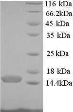 Recombinant Human Pterin-4-alpha-carbinolamine dehydRatase (PCBD1), Homo sapiens (Human), Yeast, N-terminal 6xHis-tagged, 13.9kDa, purity >90% as determined by SDS-PAGE.