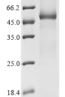 (Tris-Glycine gel) Discontinuous SDS-PAGE (reduced) with 5% enrichment gel and 15% separation gel.