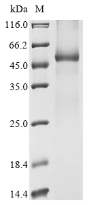 Recombinant Human UDP-glucuronosyltransferase 1A8 (UGT1A8) Protein, Homo sapiens (Human), in vitro E.coli expression system, N-terminal 10xHis-tagged, 59.9kDa, purity >85% as determined by SDS-PAGE.