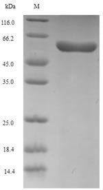 Recombinant Human Procollagen C-endopeptidase enhancer 2 (PCOLCE2), Homo sapiens (Human), E.coli, N-terminal 6xHis-SUMO-tagged, 59.3kDa, purity >90% as determined by SDS-PAGE.