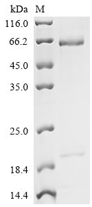 Recombinant Human Proprotein convertase subtilisin/kexin type 9 (PCSK9) (D374Y), partial, Homo sapiens (Human), Mammalian cell, C-terminal 6xHis-tagged, 73.3kDa, purity >90% as determined by SDS-PAGE.