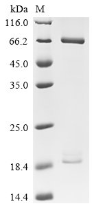 Recombinant Human Proprotein convertase subtilisin/kexin type 9 (PCSK9) (D374Y), Biotinylated (Active), Homo sapiens (Human), Mammalian cell, C-terminal 10xHis-Avi-tagged, 76.0kDa, purity >95% as determined by SDS-PAGE.