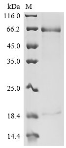 Recombinant Human Proprotein convertase subtilisin/kexin type 9 (PCSK9) (R194A), partial, Homo sapiens (Human), Mammalian cell, C-terminal 6xHis-tagged, 73.2kDa, purity >90% as determined by SDS-PAGE.