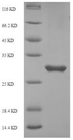 Recombinant Human Programmed cell death protein 1 (PDCD1), partial, Homo sapiens (Human), E.coli, N-terminal 6xHis-SUMO-tagged, 32.8kDa, purity >90% as determined by SDS-PAGE.