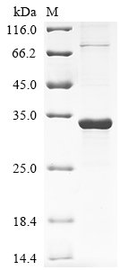 Recombinant Human Protein RRP5 homolog (PDCD11), partial