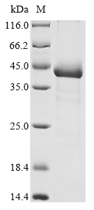 Recombinant Human Pyruvate dehydrogenase E1 component subunit beta, mitochondrial (PDHB)