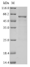 Recombinant Human Pyruvate dehydrogenase protein X component, mitochondrial (PDHX)