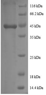 Recombinant Human Prefoldin subunit 5 (PFDN5)
