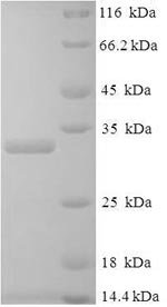 Recombinant Human Placenta growth factor (PGF), Homo sapiens (Human), E.coli, N-terminal 6xHis-SUMO-tagged, 33.3kDa, purity >90% as determined by SDS-PAGE.