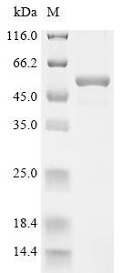 Recombinant Human D-3-phosphoglycerate dehydrogenase (PHGDH), partial