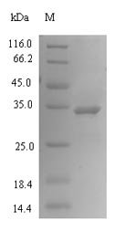 Recombinant Human Phosphoethanolamine/phosphocholine phosphatase (PHOSPHO1), Homo sapiens (Human), E.coli, N-terminal 6xHis-tagged, 33.7kDa, purity >90% as determined by SDS-PAGE.