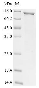 Recombinant Human Progesterone-induced-blocking factor 1 (PIBF1), Homo sapiens (Human), E.coli, N-terminal 10xHis-tagged and C-terminal Myc-tagged, 97.2kDa, purity >90% as determined by SDS-PAGE.