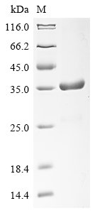 Recombinant Human Phosphatidylinositol 3-kinase regulatory subunit beta (PIK3R2), partial