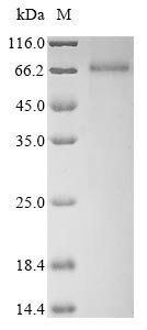 Recombinant Human Polycystin-1 (PKD1), partial, Homo sapiens (Human), E.coli, N-terminal 6xHis-tagged and C-terminal 6xHis-tagged, 66.5kDa, purity >85% as determined by SDS-PAGE.
