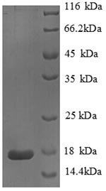 Recombinant Human Phospholipase A2, membrane associated (PLA2G2A)