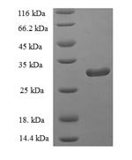 Recombinant Human Group IID secretory phospholipase A2 (PLA2G2D), partial