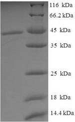 Recombinant Human Tissue-type plasminogen activator (PLAT), partial, Homo sapiens (Human), E.coli, N-terminal 6xHis-SUMO-tagged, 43.1kDa, purity >90% as determined by SDS-PAGE.
