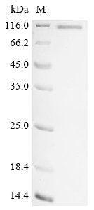 Recombinant Human Serine/threonine-protein kinase PLK2 (PLK2), Homo sapiens (Human), E.coli, N-terminal 10xHis-tagged and C-terminal Myc-tagged, 85.8kDa, purity >90% as determined by SDS-PAGE.
