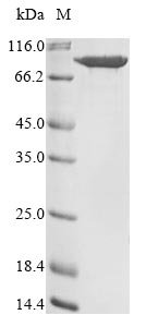 Recombinant Human Multifunctional procollagen lysine hydroxylase and glycosyltransferase LH3 (PLOD3)