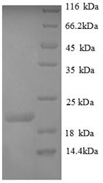 Recombinant Human Plexin-A1 (PLXNA1), partial, Homo sapiens (Human), E.coli, N-terminal 6xHis-tagged, 22.3kDa, purity >90% as determined by SDS-PAGE.