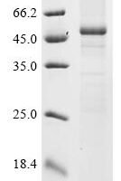 (Tris-Glycine gel) Discontinuous SDS-PAGE (reduced) with 5% enrichment gel and 15% separation gel.