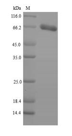 Recombinant Human Patatin-like phospholipase domain-containing protein 2 (PNPLA2), Homo sapiens (Human), E.coli, N-terminal 6xHis-SUMO-tagged, 71.3kDa, purity >90% as determined by SDS-PAGE.
