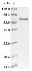 Recombinant Human Podocalyxin (PODXL), partial