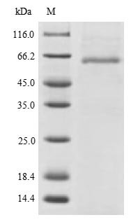 Recombinant Human Podocalyxin protein (PODXL), partial