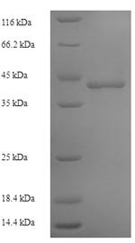 Recombinant Human DNA-directed RNA polymerase III subunit RPC1 (POLR3A), partial, Homo sapiens (Human), E.coli, N-terminal 6xHis-SUMO-tagged, 43.4kDa, purity >90% as determined by SDS-PAGE.