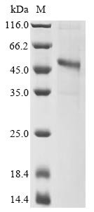 Recombinant Ross river virus Structural polyprotein, partial Protein, Ross river virus (strain T48) (RRV), in vitro E.coli expression system, N-terminal 10xHis-tagged, 50.3kDa, purity >85% as determined by SDS-PAGE.