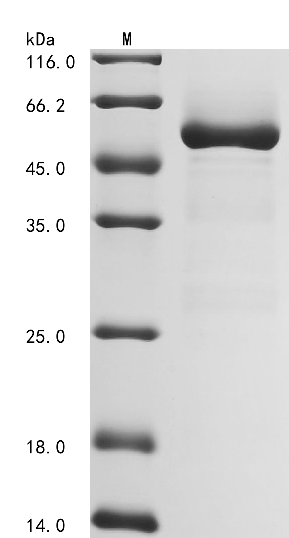 Recombinant Human Inorganic pyrophosphatase (PPA1)