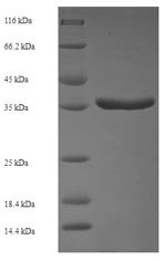 Recombinant Human Protein phosphatase 1B (PPM1B)