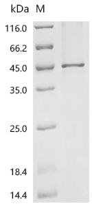 Recombinant Mouse Phosphatidylcholine:ceramide cholinephosphotransferase 1 (Sgms1) Protein, Mus musculus (Mouse), in vitro E.coli expression system, N-terminal 10xHis-tagged, 50.8kDa, purity >90% as determined by SDS-PAGE.