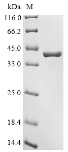 Recombinant Human Serine/threonine-protein phosphatase 2A catalytic subunit alpha isoform (PPP2CA), Homo sapiens (Human), E.coli, N-terminal 10xHis-tagged and C-terminal Myc-tagged, 43.0kDa, purity >90% as determined by SDS-PAGE.