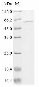 Recombinant Human Serine/threonine-protein phosphatase 2A regulatory subunit B' subunit gamma (PPP2R3C), Homo sapiens (Human), E.coli, C-terminal 6xHis-tagged, 60.2kDa, purity >90% as determined by SDS-PAGE.