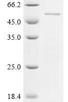 (Tris-Glycine gel) Discontinuous SDS-PAGE (reduced) with 5% enrichment gel and 15% separation gel.