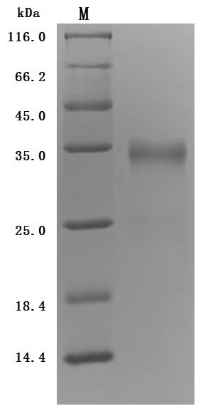 Recombinant Human Prolactin receptor (PRLR), partial (Active)